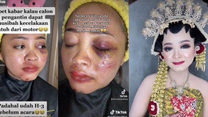 Viral Pengantin Kecelakaan H-3 Sebelum Menikah, Wajah Penuh Lebam, Hasil Riasan Tuai Pujian