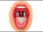 Lipsus-Difteri-di-Ternate.jpg
