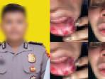 penganiaan-bripda-savero-ke-yunita.jpg