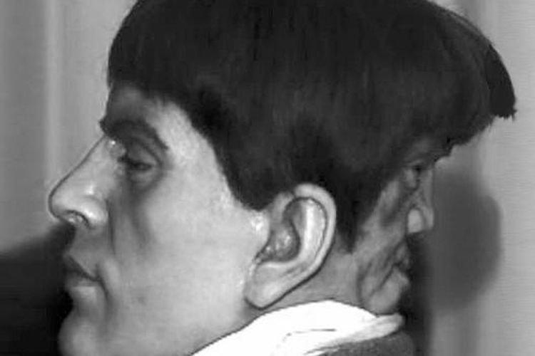 Menguak Misteri Edward Mordrake, Pria yang Diduga Memiliki Satu Kepala dan Dua Wajah