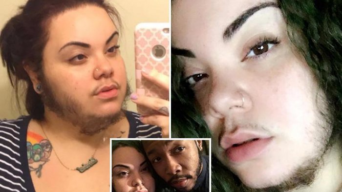 Alma Torres - Dicibir Karena Miliki Jenggot dan Kumis, Begini Cara Wanita Ini Bungkam Netter