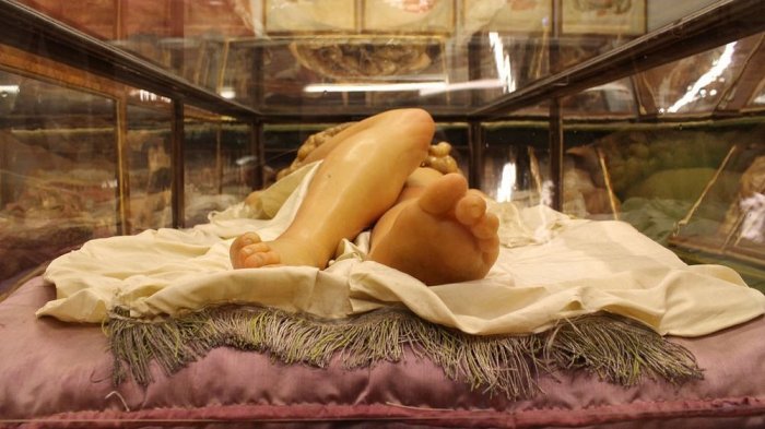 Tubuh Terbelah dan Organ Berceceran, Model Abad 18 Ini Jadi Sumber Pengetahuan yang Menyeramkan