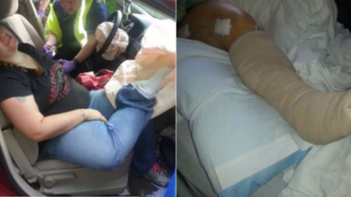 Tak Ingin Mengalami Nasib Seperti Wanita Ini? Stop Letakkan Kaki di Dasbor Mobil Sekarang Juga