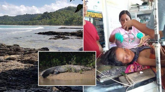 Tak Kenal Rasa Takut, Ayah Asal Filipina Ini Nekat Gigit Kaki Buaya yang Menyerang Putranya