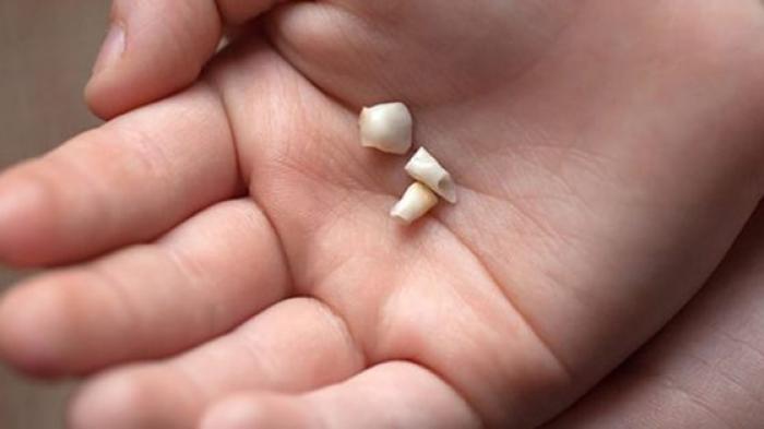 Terungkap! Jangan Buang Gigi Susu, Ternyata Ini Manfaat Berharga Bagi Tubuh