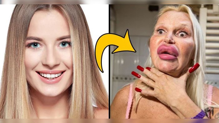 Banyak Duit Mah Bebas! 5 Orang Ini Rela Operasi Plastik Puluhan Kali demi Penampilan Mirip Idolanya