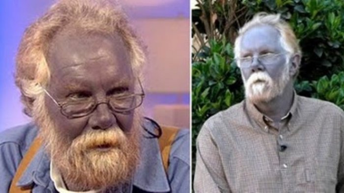 Dari Tak Pernah Keluar Rumah hingga Berkulit Biru, Inilah Kehidupan 3 Keluarga Unik di Dunia