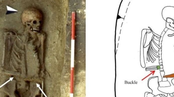 Misteri Kerangka Manusia Abad Pertengahan Terungkap, Arkeolog Terkejut dengan Apa yang Terjadi