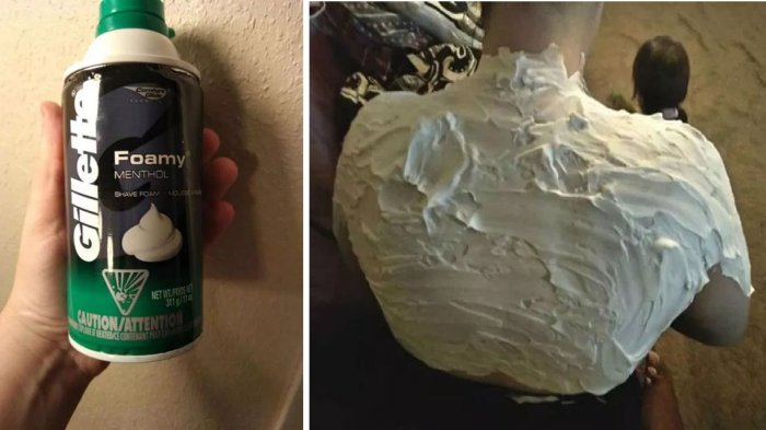 Gunakan Bahan Sederhana, Tips Mengatasi Kulit Terbakar Matahari Ala Wanita Texas Ini Jadi Viral