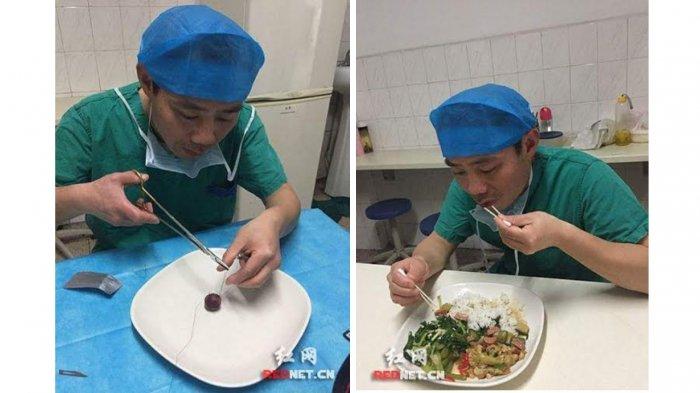 Viral Medsos - Terungkap! Inilah Alasan Dokter Bedah Ini Makan Pakai Cotton Bud, Sungguh Mulia