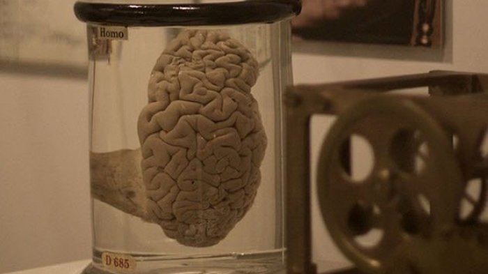 Bukan Lukisan atau Patung! 7 Museum Ini Sengaja Tampilkan Organ Tubuh Manusia, Satunya Otak Einsten