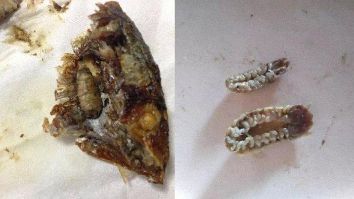 Viral di Medsos, Seorang Wanita Temukan Parasit saat Asyik Menyantap Ikan