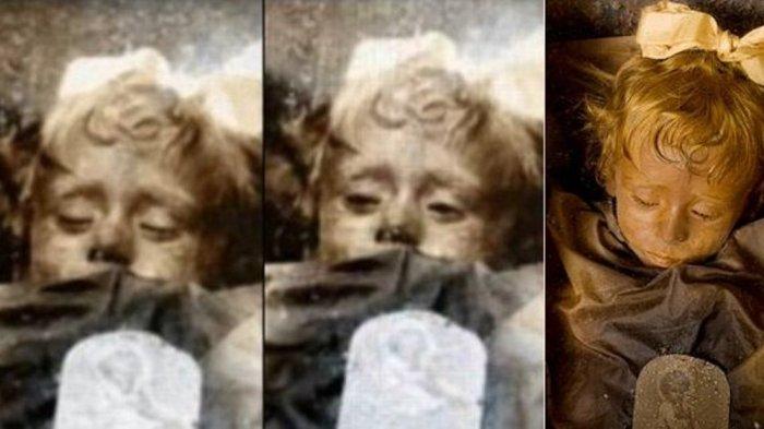 Rosalia Lombardo, Mumi yang Mampu 'Mengedipkan' Mata