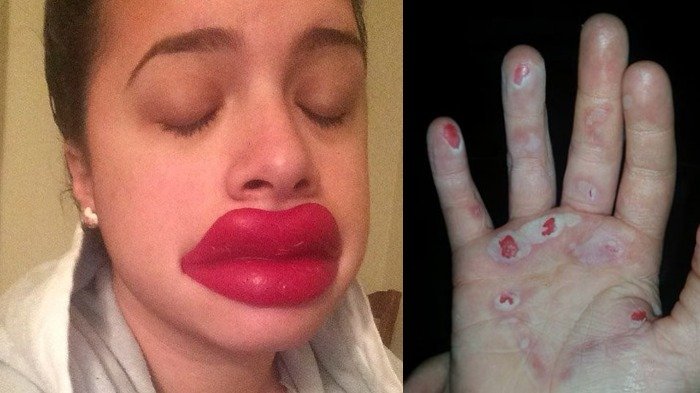 5 Tantangan Terbodoh yang Berubah Menjadi Bencana, Ada yang Sebabkan Kematian Juga