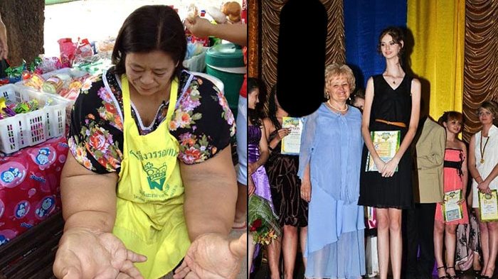 6 Wanita Ini Memiliki Tubuh Langka, Ada yang Lehernya Mirip Jerapah Hingga Tubuh Elastis