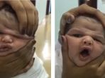 bayi-yang-kepalanya-diremas_20180109_164641.jpg