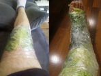 bungkus-kaki-dengan-kubis_20180430_155005.jpg