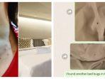 cerita-wisatawan-mengalami-gatal-gatal-digigit-kutu-kasur-saat-menginap-di-sebuah-hotel.jpg