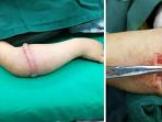 gadis-dan-karet-gelang_20180427_140251.jpg