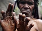 Ikipalin Papua - Wow! Masyarakat di Sini Sengaja Memotong Jari Tangannya, Alasannya Mengejutkan