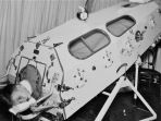 iron-lung-polio_20170224_220710.jpg