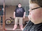 Jacob Miller - Saat Remaja Bobotnya 300 Kg, Bocah Ini Lakukan Operasi Lambung! Hasilnya Luar Biasa