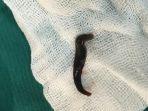 leech.jpg