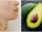 6 Masker Alami Berbahan Bumbu Dapur yang Ampuh Atasi 6 Masalah di Wajah, Bisa Dibuat Sendiri!