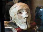 mtter-museum.jpg