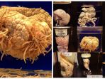 museum-parasitologi-megure-tokyo_20181106_164210.jpg