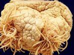 parasit-yang-dipajang-di-parasitologi-meguro.jpg