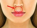 philtrum_20180513_143919.jpg