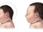 virus-zika_20160903_173318.jpg