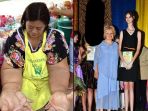 wanita-dengan-kondisi-luar-biasa_20170727_103253.jpg
