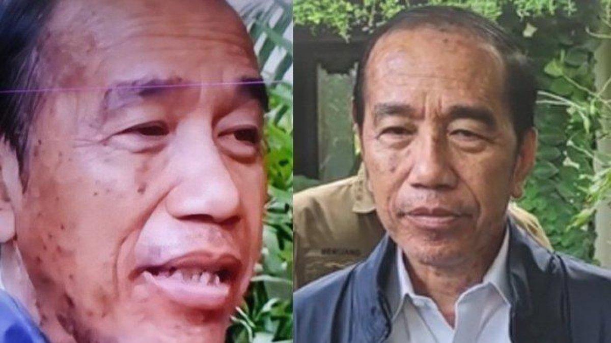 JOKOWI ALERGI KULIT - Dokter Tifa yang gencar membahas ijazah Jokowi blak-blakan menyebut soal penyakit Autoimun. Rupanya Jokowi alami alergi kulit sehingga mucul flek hitam di wajah hingga tak ikut upacara di Gedung Pancasila.