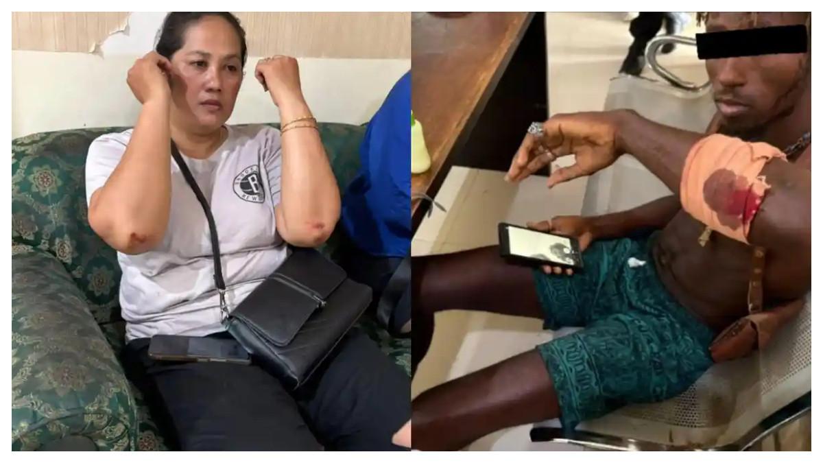 Kondisi WNA AS berinisial MD dan korban Ni Komang mengalami luka-luka, keduanya sudah diminta keterangan pihak kepolisian. Istimewa/Polresta Denpasar