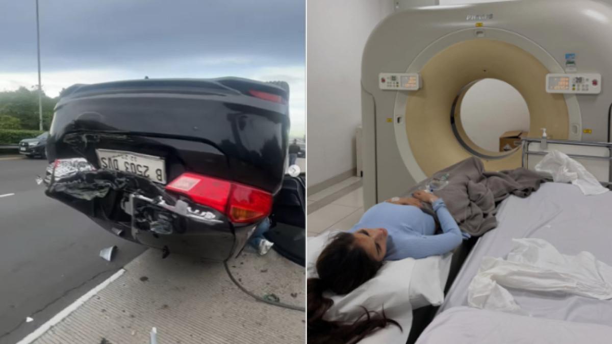 KECELAKAAN - Model sekaligus pesinetron Diva Siregar alami kecelakaan tragis di Tol Jagorawi. Dokter sampai takjub mendapati Diva Siregar masih bisa selamat mengingat parahnya kondisi mobil.