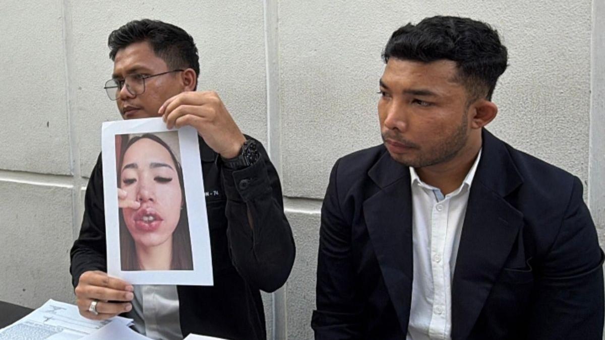 DOKTER GADUNGAN DITANGKAP - Mantan finalis Puteri Indonesia berinisial JRF diamankan polisi setelah diduga menjalankan praktik kecantikan ilegal yang menyebabkan sejumlah korban mengalami luka serius hingga cacat permanen, April 2026.