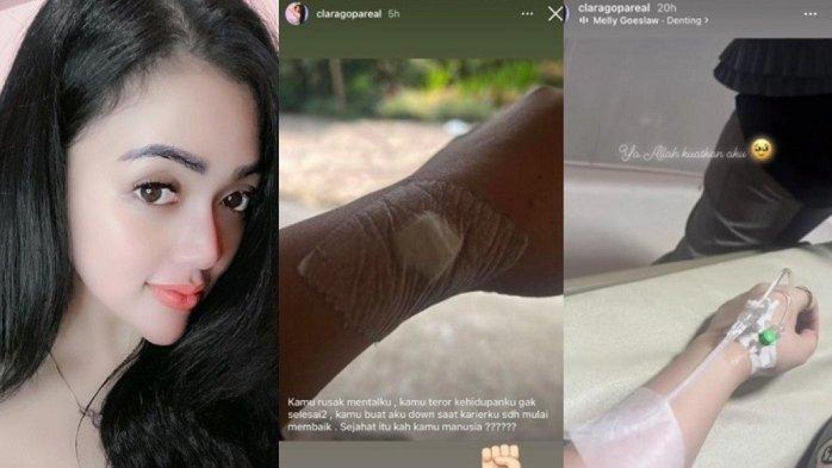 ASTAGHFIRULLAH Artis Diteror sampai Kena Mental, Dulu Eksis Jadi Personel Duo Semangka Goyang Mantul