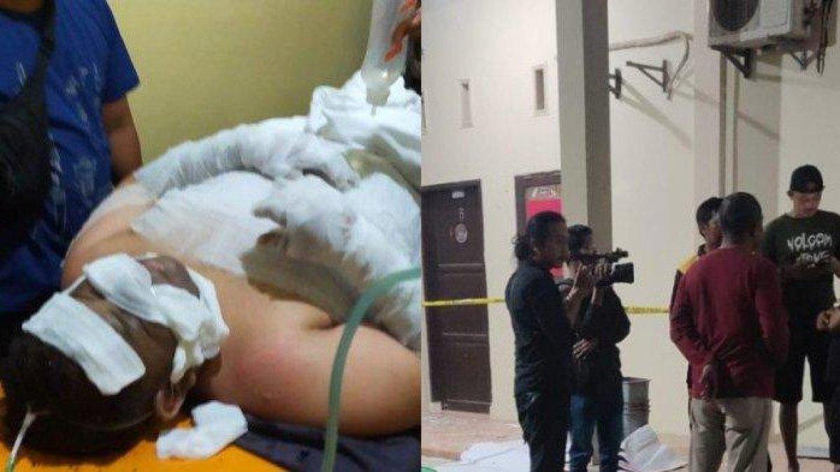 DUARRR! Niatnya Merokok Sambil BAB, Yusuf Syok Septic Tank Meledak, Kini Sekujur Tubuh Penuh Perban