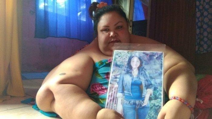 INNALILLAHI Titi Wati Wanita Obesitas Asal Palangkaraya Meninggal Dunia, Dulu Viral Bobotnya 200 Kg