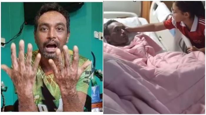 Artis-depresi-5-tahun-sakit-kulit-tak-sembuh-sembuh-takut-anak-istri-jijik-kini-meninggal.jpg