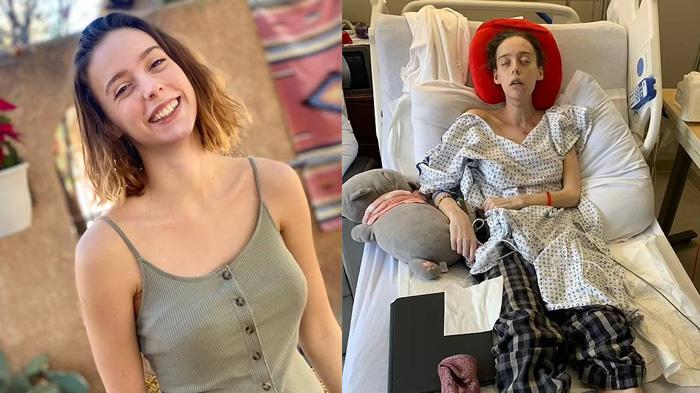 Luka di Lidah Salah Diagnosa, Wanita Ternyata Derita Penyakit Serius, Kesakitan: Biarkan Aku Mati