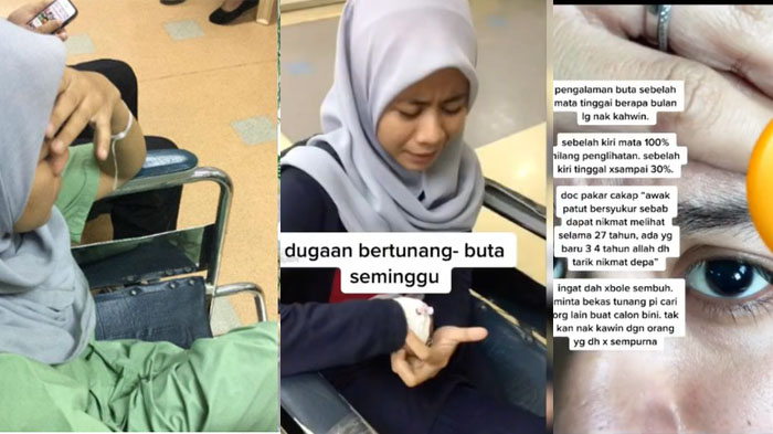 'Saya Tak Layak' Pilu Gadis Mendadak Buta Jelang Nikah, Ikhlaskan Calon Suami: Carilah yang Sempurna