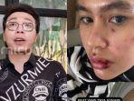 Ditertawakan-Richard-Lee-Kartika-Putri-Tahan-Malu-Disentil-soal-Azab.jpg