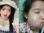 Gadis-kehilangan-nyawa-setelah-operasi-gigi-pipi-bengkak-a.jpg