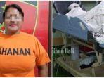 Istri-siram-suami-air-keras-dan-air-cabai-gegara-nikah-lagi-kiri-ilustrasi-korban-bakar-kanan.jpg