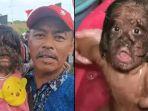 Missclyen-bocah-2-tahun-asal-Malaysia-alami-hipertrikosis-dia-dijuluki-manusia-serigala.jpg