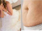 Pengantin-wanita-nangis-dicerai-saat-maam-pertama-gara-gara-perutnya-ada-stretch-mark.jpg