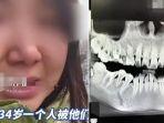 Wanita-di-Cina-meninggal-jatuh-dari-lantai-11-setelah-dokter-salah-cabut-giginya.jpg